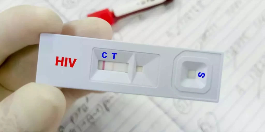 تصویر 4 از کیت تشخیص بیماری ایدز با دقت بالا و پاسخ سریع